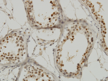 KPNA1 monoclonal antibody (M01), clone 2A4-1B5