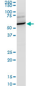 KPNA1 polyclonal antibody (A02)