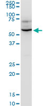 KPNA1 polyclonal antibody (A02)