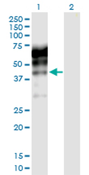 KNG1 purified MaxPab rabbit polyclonal antibody (D01P)