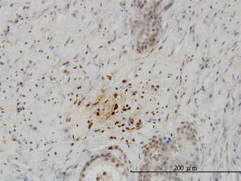 KISS1 monoclonal antibody (M05), clone 1F7