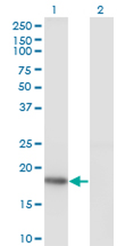 KISS1 monoclonal antibody (M05), clone 1F7