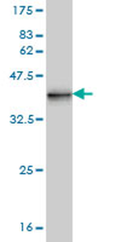 KISS1 monoclonal antibody (M05), clone 1F7