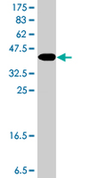 KCNN3 polyclonal antibody (A01)