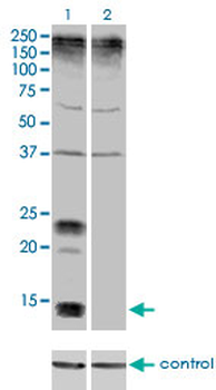KCNE1 monoclonal antibody (M01), clone 5B12