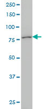 KCNC3 monoclonal antibody (M01), clone 1C1