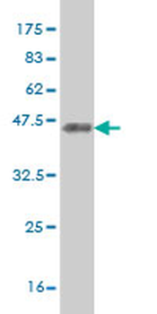 KCNC3 monoclonal antibody (M01), clone 1C1