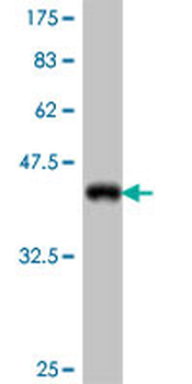 KAL1 polyclonal antibody (A01)