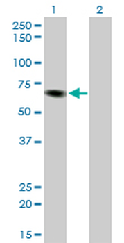 ITPKB monoclonal antibody (M01), clone 2F8
