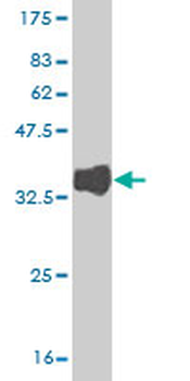 ITPKB monoclonal antibody (M01), clone 2F8