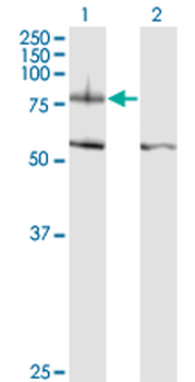 ITGB8 monoclonal antibody (M01), clone 2B4