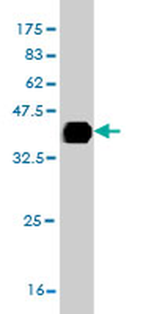 ITGB8 monoclonal antibody (M01), clone 2B4