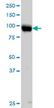 ITGB5 monoclonal antibody (M01), clone 2C4