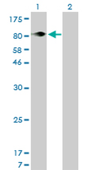 ITGB5 monoclonal antibody (M01), clone 2C4