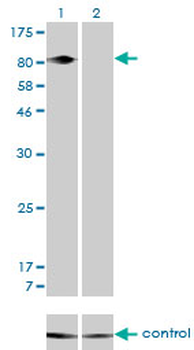 ITGB5 monoclonal antibody (M01), clone 2C4