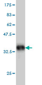 ITGB5 monoclonal antibody (M01), clone 2C4