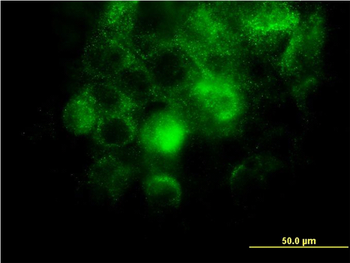 ITGA2 monoclonal antibody (M01), clone 2B6