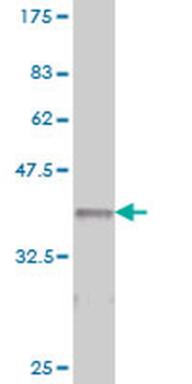 ITGA2 monoclonal antibody (M01), clone 2B6