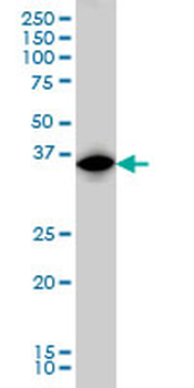 IRF1 monoclonal antibody (M01), clone 2E4