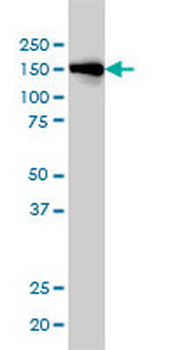 INPPL1 monoclonal antibody (M01), clone 3E6