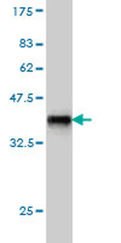 INPPL1 monoclonal antibody (M01), clone 3E6
