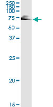 IMPDH2 monoclonal antibody (M01), clone 1E12-B6