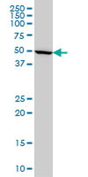 IMPDH1 monoclonal antibody (M01), clone 3G6