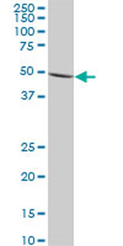 IMPDH1 monoclonal antibody (M01), clone 3G6