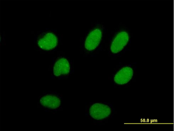 ILF2 purified MaxPab mouse polyclonal antibody (B01P)