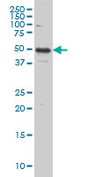 IL13RA2 monoclonal antibody (M01), clone 2E10