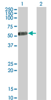 IL13RA2 monoclonal antibody (M01), clone 2E10