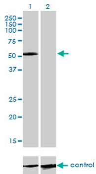 IL13RA2 monoclonal antibody (M01), clone 2E10