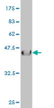 IL13RA2 monoclonal antibody (M01), clone 2E10