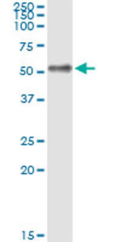 IL1RAP monoclonal antibody (M06), clone 2A3