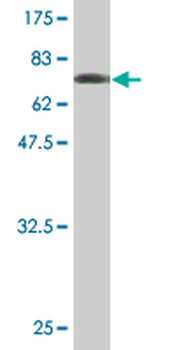 IL1RAP monoclonal antibody (M06), clone 2A3
