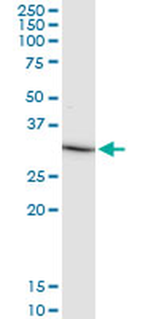 IL1B monoclonal antibody (M01), clone 2A8