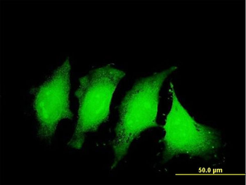 IL1B monoclonal antibody (M01), clone 2A8