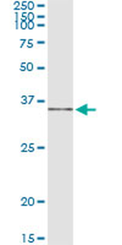 IL1B monoclonal antibody (M01), clone 2A8