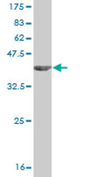 IL1B monoclonal antibody (M01), clone 2A8