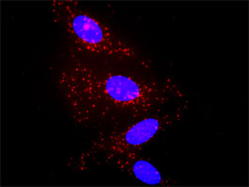 IL1B purified MaxPab rabbit polyclonal antibody (D01P)