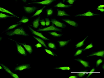 IGFBP3 purified MaxPab rabbit polyclonal antibody (D01P)