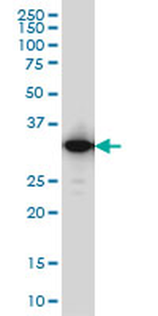 IFI35 monoclonal antibody (M01), clone 3H6