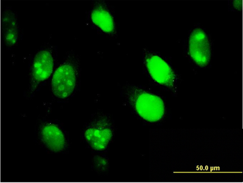 IFI16 monoclonal antibody (M03), clone 2E3
