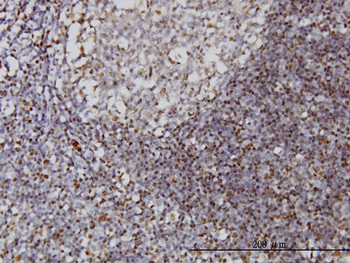 IFI16 monoclonal antibody (M03), clone 2E3