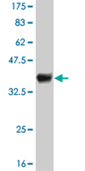 IFI16 monoclonal antibody (M03), clone 2E3