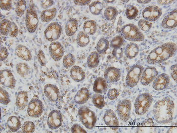 IDH2 monoclonal antibody (M01), clone 5F11
