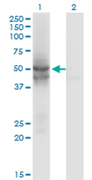 IDH2 monoclonal antibody (M01), clone 5F11