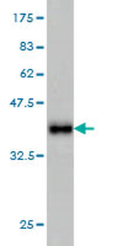 IDH2 monoclonal antibody (M01), clone 5F11