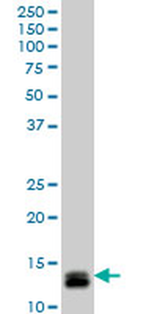 ID1 monoclonal antibody (M04), clone 4G11