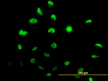 ID1 monoclonal antibody (M04), clone 4G11